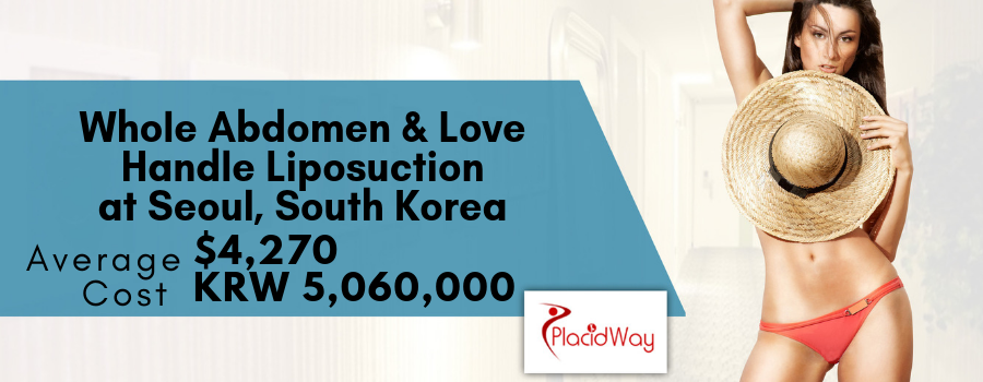The average cost of Whole Abdomen and Love Handle Liposuction at Seoul, South Korea is $16,250KRW 19,350,000